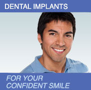 Man smiling - Dental Implants.  For your confident smile